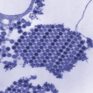 anti-viral testing, US Center for Disease Control CDC TEM photo of Chikungunya virus