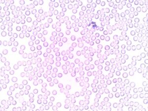 immunohistochemistry
