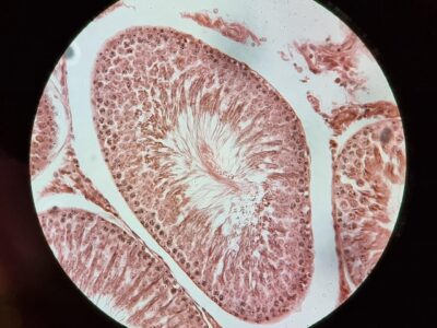Microscopic view of stained tissue showing detailed cellular structures in pink and red tones within a circular field of view.