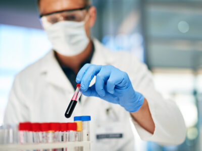 Cropped shot of a male doctor working with blood samples in his lab