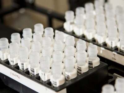 Close-up of trays with eppendorf screwcap vials in a lab setting.